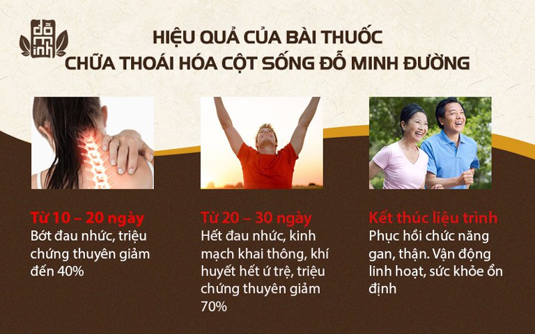 Hiệu quả điều trị thoái hóa cột sống của bài thuốc Xương khớp Đỗ Minh