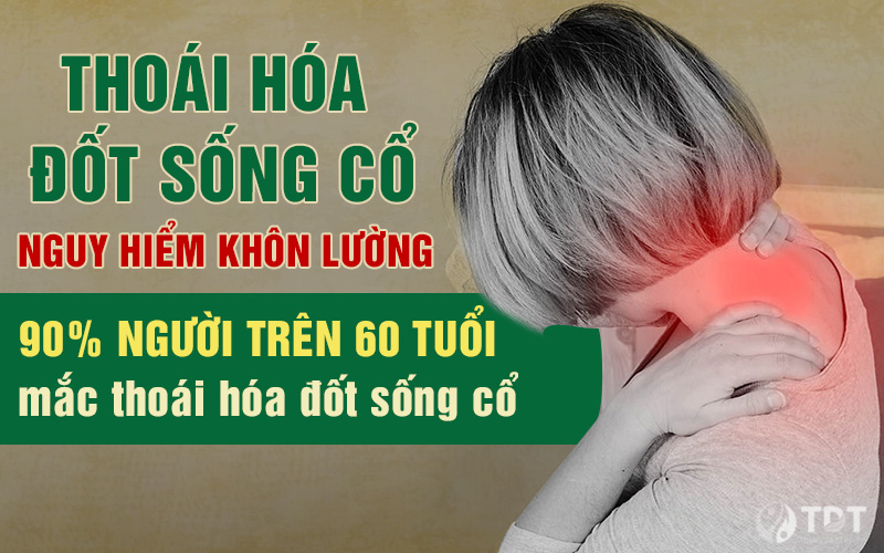 Thoái hóa đốt sống cổ