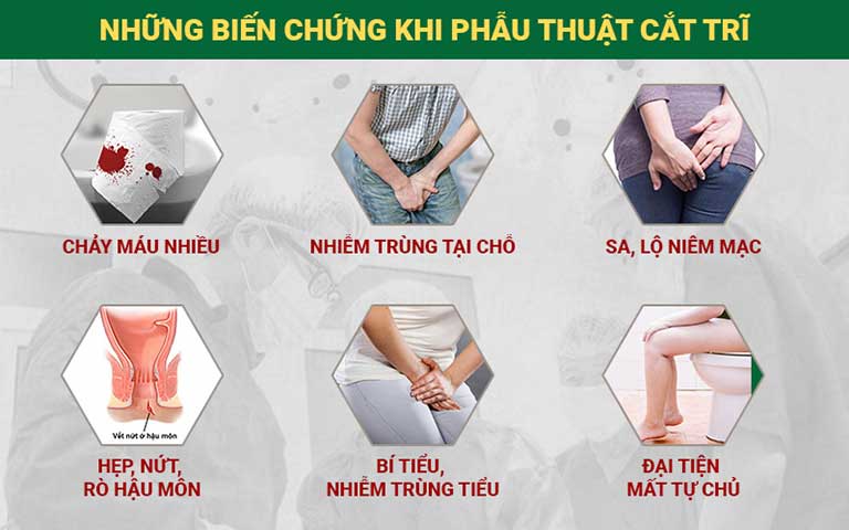 Biến chứng gặp phải sau khi cắt trĩ