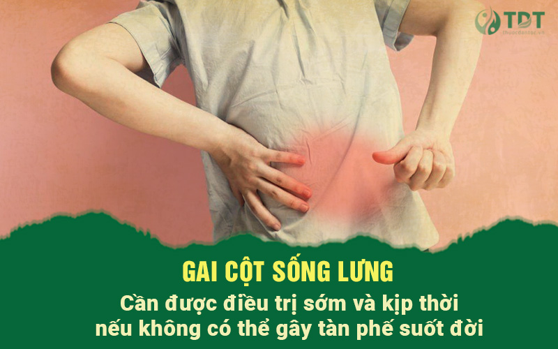 Bệnh gai cột sống lưng có nguy hiểm không