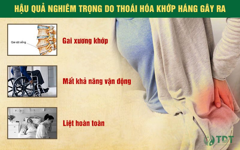 Biến chứng của bệnh thoái hóa khớp háng