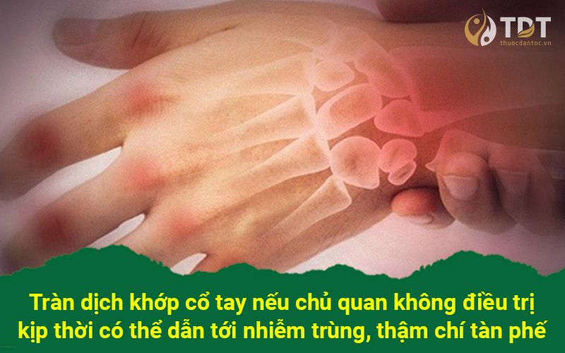 biến chứng của tràn dịch khớp cổ tay