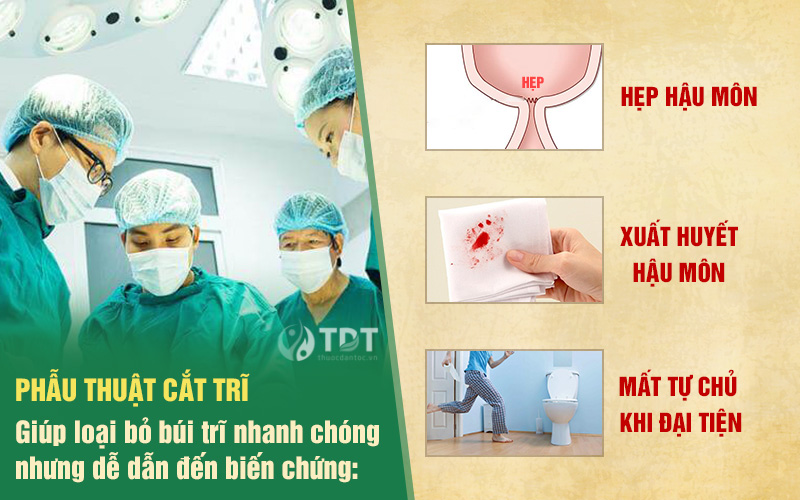 Biến chứng của phẫu thuật cắt trĩ