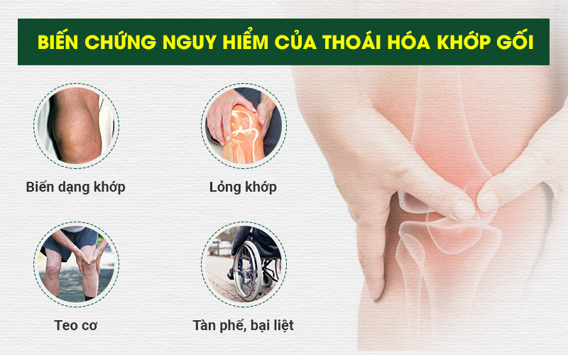 biến chứng của bệnh thoái hóa khớp gối