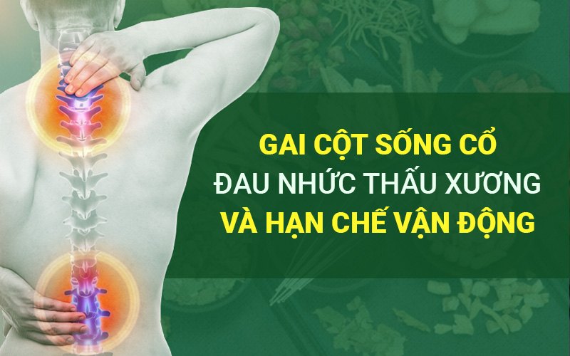 Biến chứng của Gai cột sống cổ