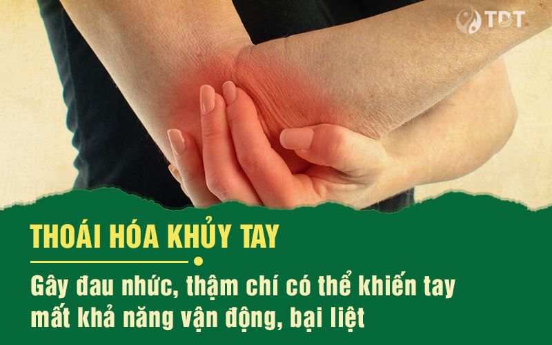 Thoái hóa khủy tay