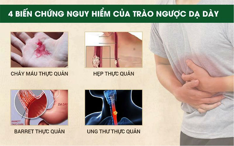 Biến chứng của trào ngược dạ dày thực quản