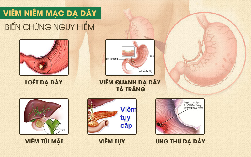 biến chứng của viêm dạ dày