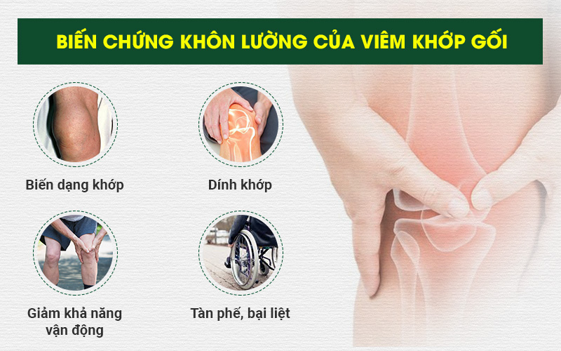 biến chứng bệnh viêm khớp gối