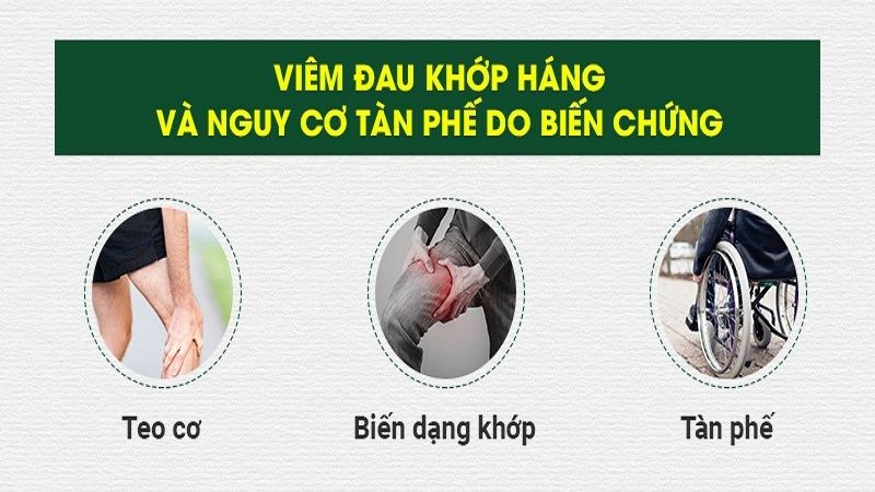 Biến chứng Viêm đau khớp háng