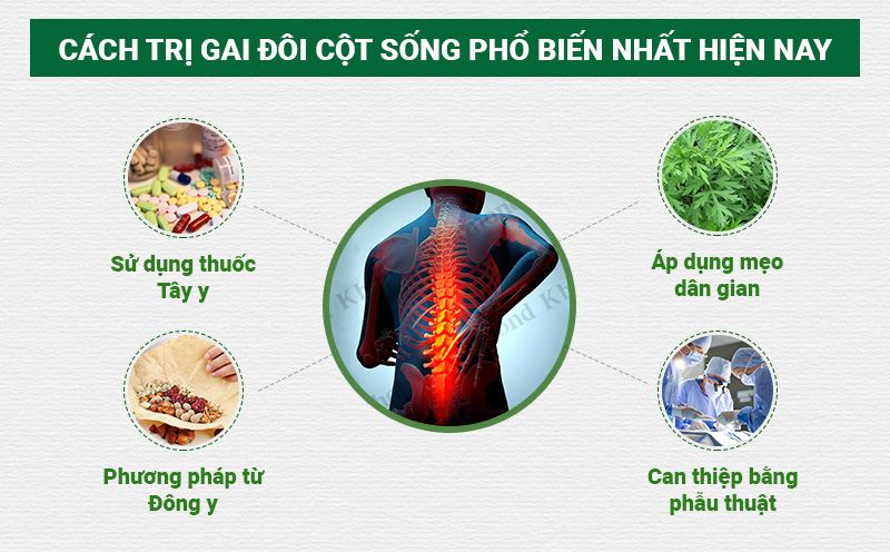 Cách trị gai đôi cột sống