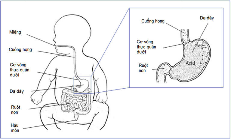 Cấu tạo hệ tiêu hóa của trẻ sơ sinh chưa hoàn thiện và rất dễ bị tổn thương