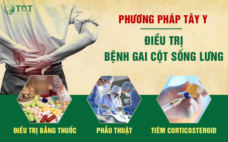 Điều trị gai cột sống lưng bằng Tây y