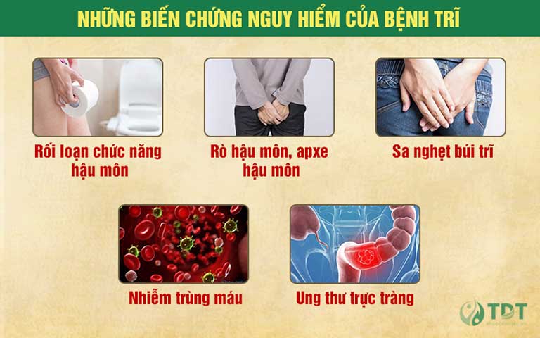 Một số biến chứng nguy hiểm của bệnh trĩ