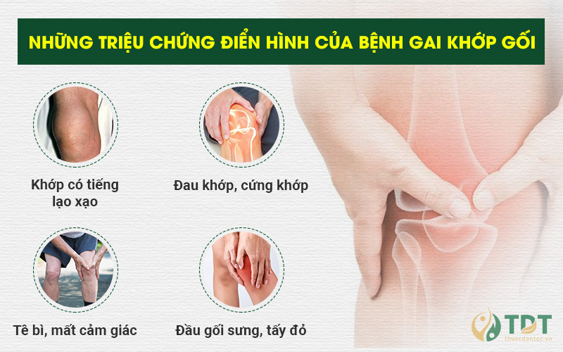 Triệu chứng gai khớp gối