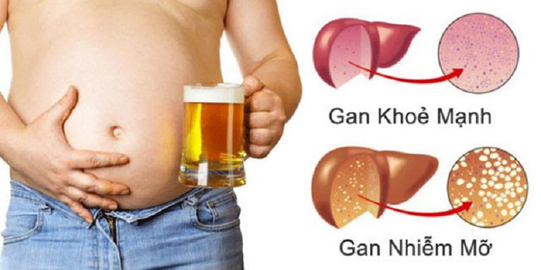 vấn đề về gan