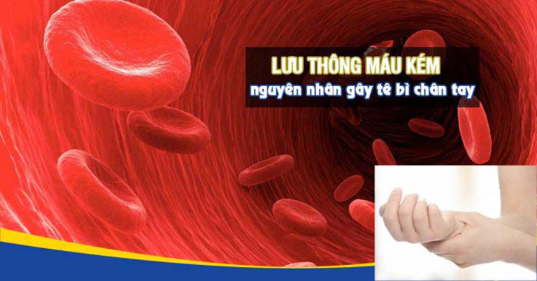 Lưu thông máu kém là nguyên nhân chính gây ra tê bì chân tay