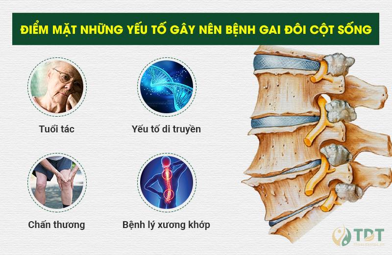 nguyên nhân gây nên bệnh gai đôi cột sống