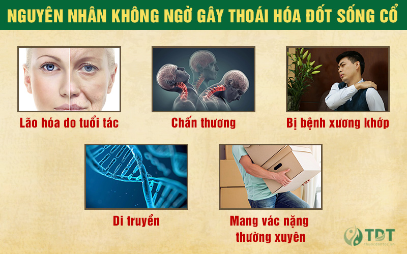 Nguyên nhân gây thoái hóa đốt sống cổ