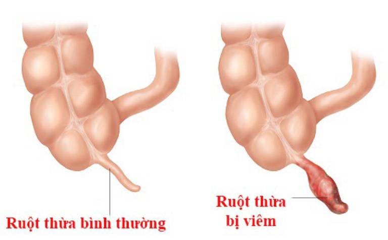 Dấu hiệu nhận biết