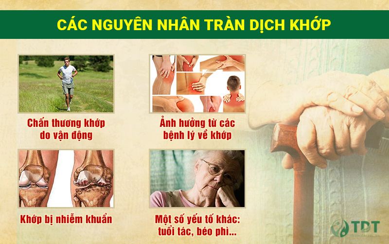 Nguyên nhân tràn dịch khớp