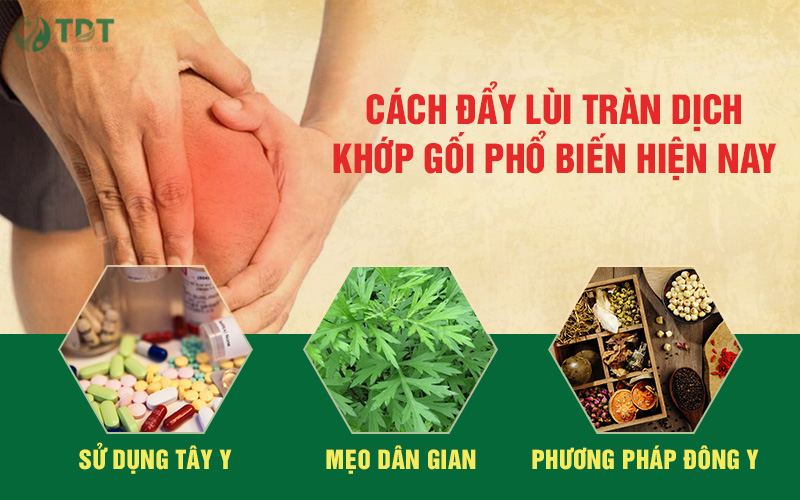 Cách đẩy lùi tràn dịch khớp gối phổ biến hiện nay