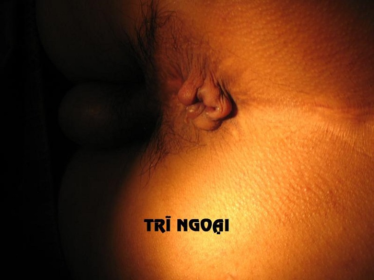 Trĩ ngoại độ 2