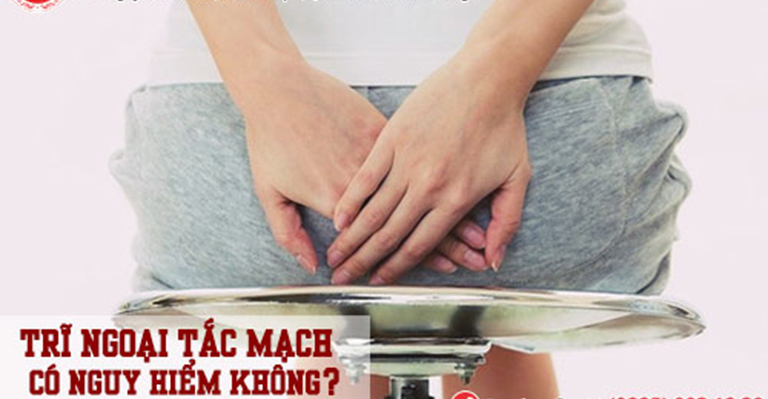 Trĩ ngoại tắc mạch là căn bệnh có gây nguy hiểm không?