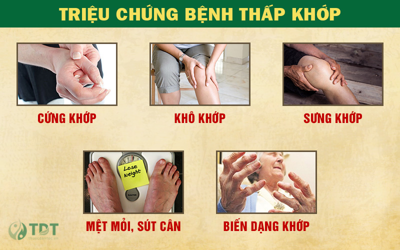 dấu hiệu bệnh thấp khớp