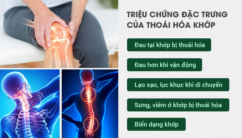 Triệu chứng thoái hóa khớp