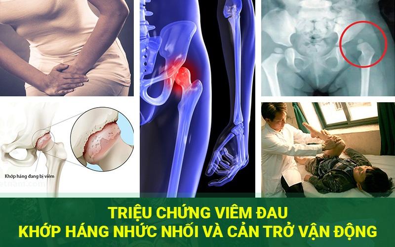 dấu hiệu viêm khớp háng