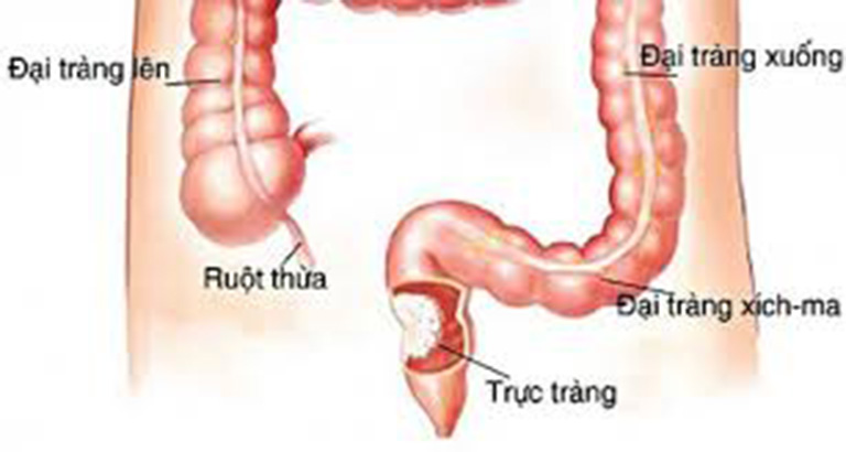 Trực tràng là gì?