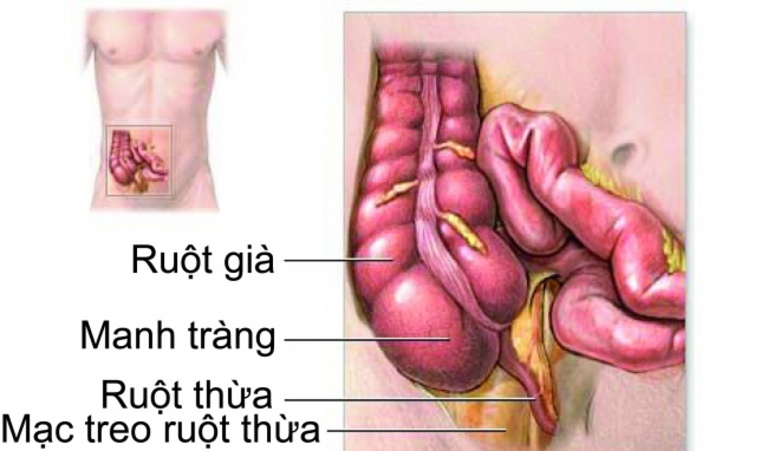 Viêm đại tràng co thắt chưa có thuốc đặc trị