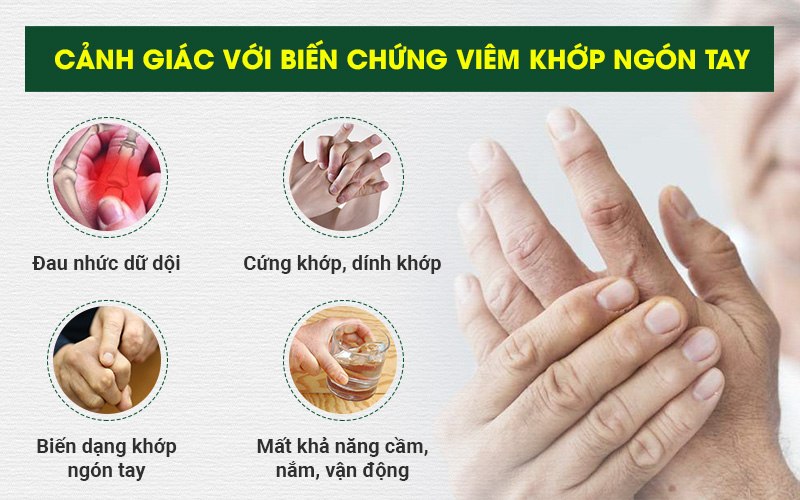 Cảnh giác với biến chứng viêm đau khớp ngón tay
