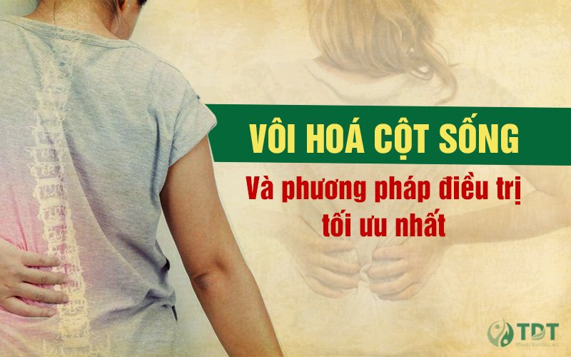 Bệnh vôi hóa cột sống là gì